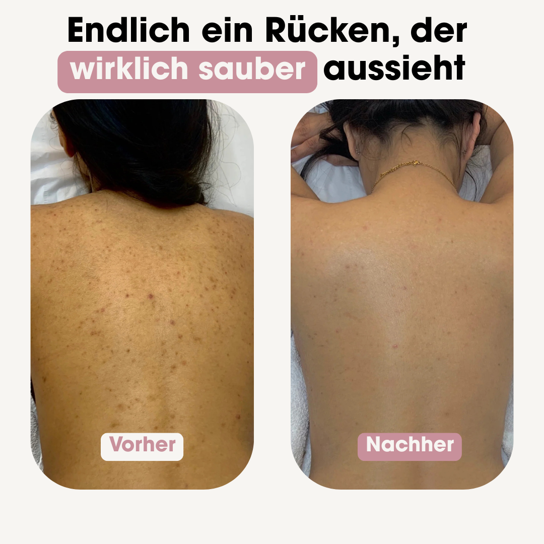 BELVIYA – Dein Rücken. Endlich gepflegt.